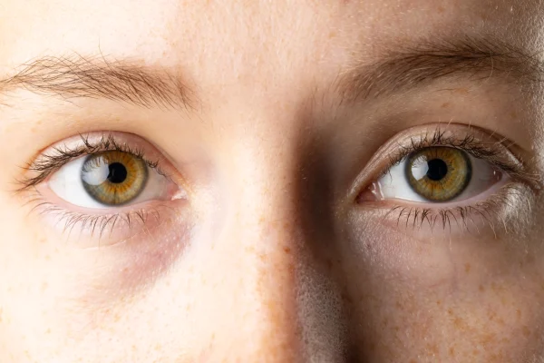 close-up-of-brown-eyes-of-caucasian-woman-with-fre-2023-09-07-03-55-06-utc