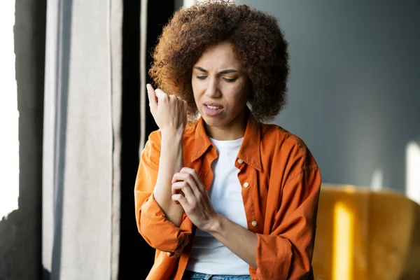woman-scratches-her-reddened-hand-due-to-itching-2023-04-05-20-08-54-utc